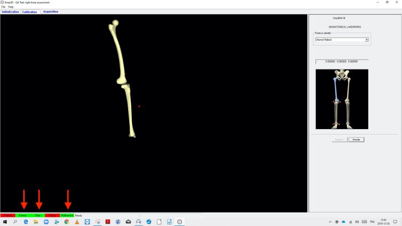 Calibration-Anatomical Landmarks Calibration-Anatomical Landmarks