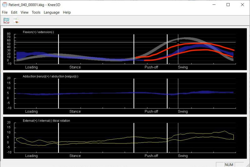 Curve Offset-Flex:Ext