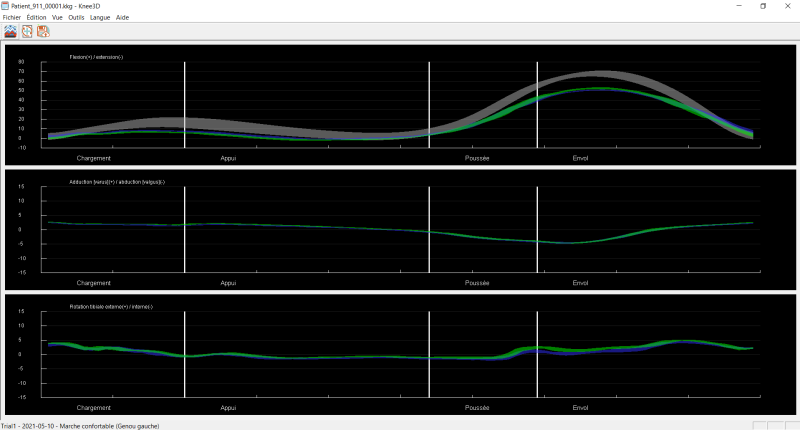 Knee3D Analysis